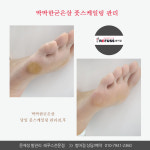 레푸스 범어점