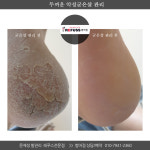 레푸스 범어점