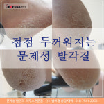 레푸스 범어점