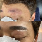 영네일