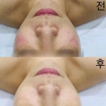 뷰티by약손