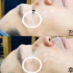뷰티by약손