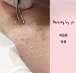 뷰티by약손