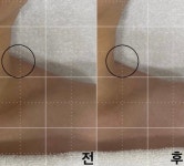 뷰티by약손