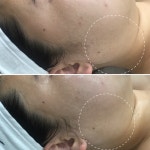 뷰티by약손