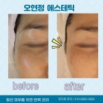 마이온스킨