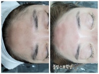 블링스왁싱 노원점