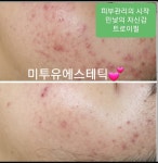 미투유에스테틱