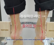 레푸스 경대점