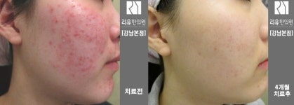 리유한의원 강남본점