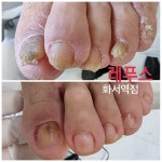 레푸스 화서역점 풋케어 발톱 발각질 문제성 발관리전문점