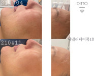 디또뷰티 평택본점