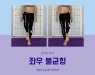 대전체형교정 밸런스핏