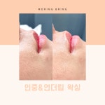 모링블링 브라질리언왁싱&속눈썹
