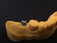 디지털라온덴탈랩