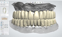 디지털라온덴탈랩