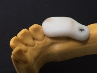 디지털라온덴탈랩