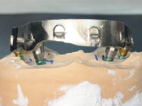 디지털라온덴탈랩