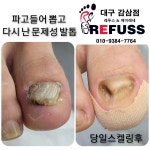 레푸스감삼점&에이레네