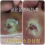 레푸스감삼점&에이레네