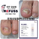 레푸스감삼점&에이레네
