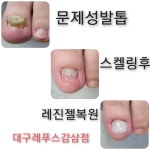 레푸스감삼점&에이레네