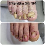 레푸스감삼점&에이레네