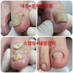 레푸스감삼점&에이레네