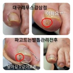 레푸스감삼점&에이레네
