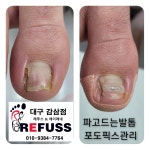 레푸스감삼점&에이레네