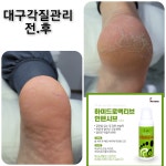 레푸스감삼점&에이레네