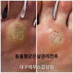 레푸스감삼점&에이레네