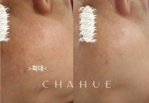약손체형관리