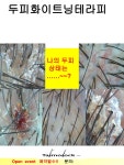 이아소에스떼