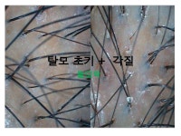 이아소에스떼