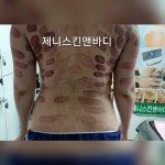 제니스킨앤바디