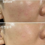새온뷰티 두골비얼굴축소연구소