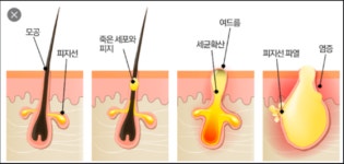 새온뷰티 두골비얼굴축소연구소