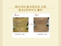 동성제약 메디커버시술센터