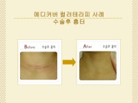 동성제약 메디커버시술센터