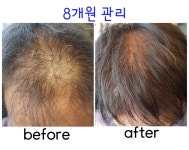 동성제약 염색센타