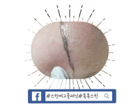 톡톡스킨 고양시본점