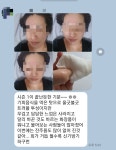마이온스킨