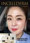 인셀덤프렌드쉽음희영
