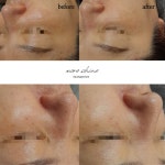 모어샤인스킨바디