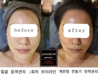 js메디스킨