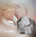 에이오제이
