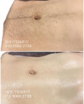 참슈가링왁싱