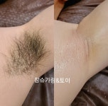 참슈가링왁싱