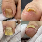 라렌느네일 페디베네 울산동구점